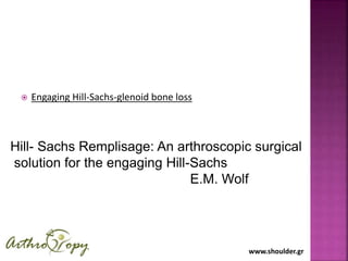 www.shoulder.gr
 Engaging Hill-Sachs-glenoid bone loss
Hill- Sachs Remplisage: An arthroscopic surgical
solution for the engaging Hill-Sachs
E.M. Wolf
 