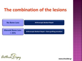 www.shoulder.grwww.shoulder.gr
The combination of the lesions
No Bone Loss Arthroscopic Bankart Repair
Glenoid Bone Loss
> 25%
Arthroscopic Bankart Repair + Bone grafting procedure
 