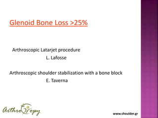 www.shoulder.gr
Glenoid Bone Loss >25%
Arthroscopic Latarjet procedure
L. Lafosse
Arthroscopic shoulder stabilization with a bone block
E. Taverna
 