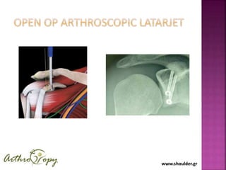 www.shoulder.gr
 