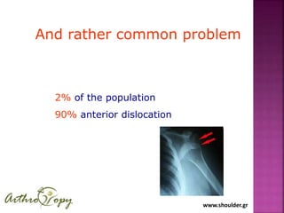www.shoulder.gr
And rather common problem
2% of the population
90% anterior dislocation
 