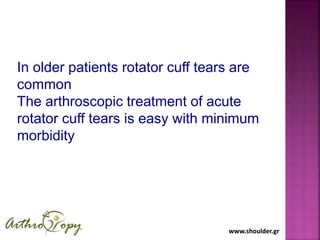 www.shoulder.grwww.shoulder.gr
In older patients rotator cuff tears are
common
The arthroscopic treatment of acute
rotator cuff tears is easy with minimum
morbidity
Conclusions
 