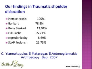 www.shoulder.grwww.shoulder.gr
Our findings in Traumatic shoulder
dislocation
 Hemarthrosis 100%
 Bankart 78.2%
 Bony Bankart 13.04%
 Hill-Sachs 65.21%
 capsular laxity 8.69%
 SLAP lesions 21.73%
C. Yiannakopulos E Mataragas E.Antonogiannakis
Arthroscopy Sep 2007
 