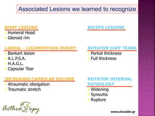 www.shoulder.grwww.shoulder.gr
BONY LESIONS
• Humeral Head
• Glenoid rim
LABRAL - LIGAMENTOUS INJURY
• Bankart lesion
• A.L.P.S.A.
• H.A.G.L.
• Capsular Tear
INCREASED CAPSULAR VOLUME
• Atraumatic elongation
• Traumatic stretch
Associated Lesions we learned to recognize
BICEPS LESIONS
ROTATOR CUFF TEARS
• Partial thickness
• Full thickness
ROTATOR INTERVAL
PATHOLOGY
• Widening
• Synovitis
• Rupture
 
