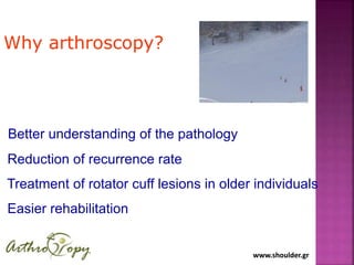 www.shoulder.grwww.shoulder.gr
Better understanding of the pathology
Reduction of recurrence rate
Treatment of rotator cuf...