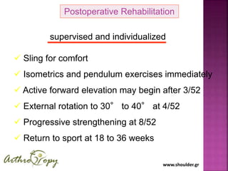 www.shoulder.gr
Postoperative Rehabilitation
 Sling for comfort
 Isometrics and pendulum exercises immediately
 Active ...