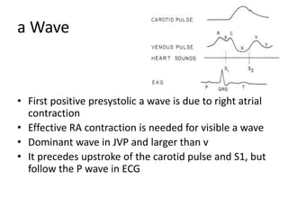 a Wave
• First positive presystolic a wave is due to right atrial
contraction
• Effective RA contraction is needed for visible a wave
• Dominant wave in JVP and larger than v
• It precedes upstroke of the carotid pulse and S1, but
follow the P wave in ECG
 