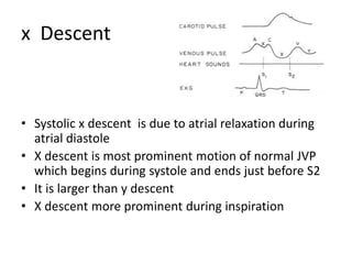 x Descent
• Systolic x descent is due to atrial relaxation during
atrial diastole
• X descent is most prominent motion of normal JVP
which begins during systole and ends just before S2
• It is larger than y descent
• X descent more prominent during inspiration
 