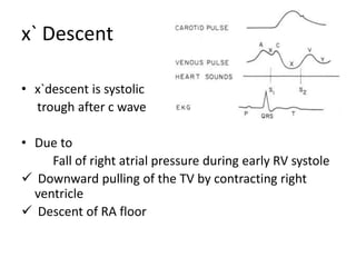 x` Descent
• x`descent is systolic
trough after c wave
• Due to
Fall of right atrial pressure during early RV systole
 Downward pulling of the TV by contracting right
ventricle
 Descent of RA floor
 