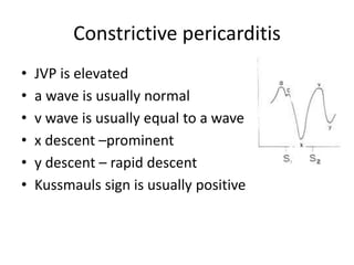Constrictive pericarditis
• JVP is elevated
• a wave is usually normal
• v wave is usually equal to a wave
• x descent –prominent
• y descent – rapid descent
• Kussmauls sign is usually positive
 