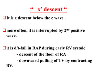 “ x’ descent “
It is x descent below the c wave .
more often, it is interrupted by 2nd positive
wave.
it is d/t-fall in RAP during early RV systole
- descent of the floor of RA
- downward pulling of TV by contracting
RV.
 