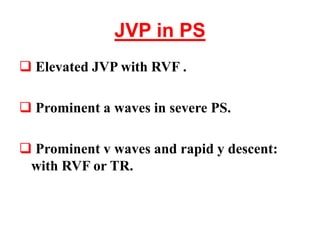 JVP in PS
 Elevated JVP with RVF .
 Prominent a waves in severe PS.
 Prominent v waves and rapid y descent:
with RVF or TR.
 