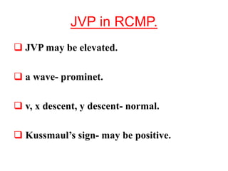JVP in RCMP.
 JVP may be elevated.
 a wave- prominet.
 v, x descent, y descent- normal.
 Kussmaul’s sign- may be positive.
 