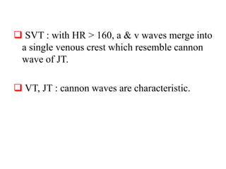  SVT : with HR > 160, a & v waves merge into
a single venous crest which resemble cannon
wave of JT.
 VT, JT : cannon waves are characteristic.
 