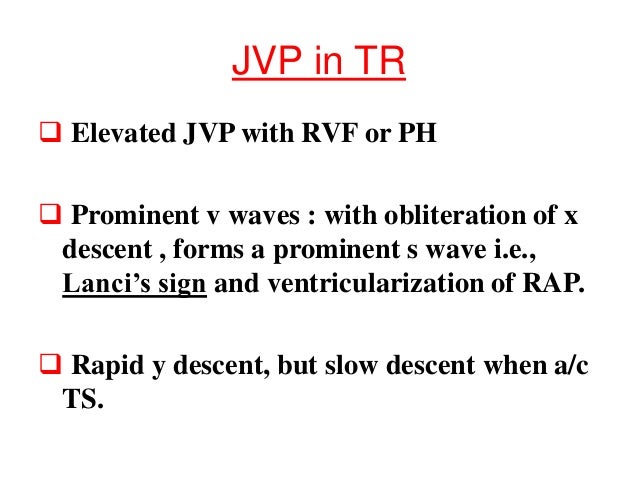 Jugular Venous Pressure Jugular Venous Pressure
