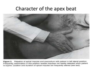 Character of the apex beat
 