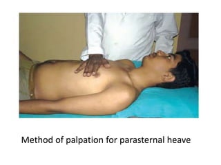 Method of palpation for parasternal heave
 