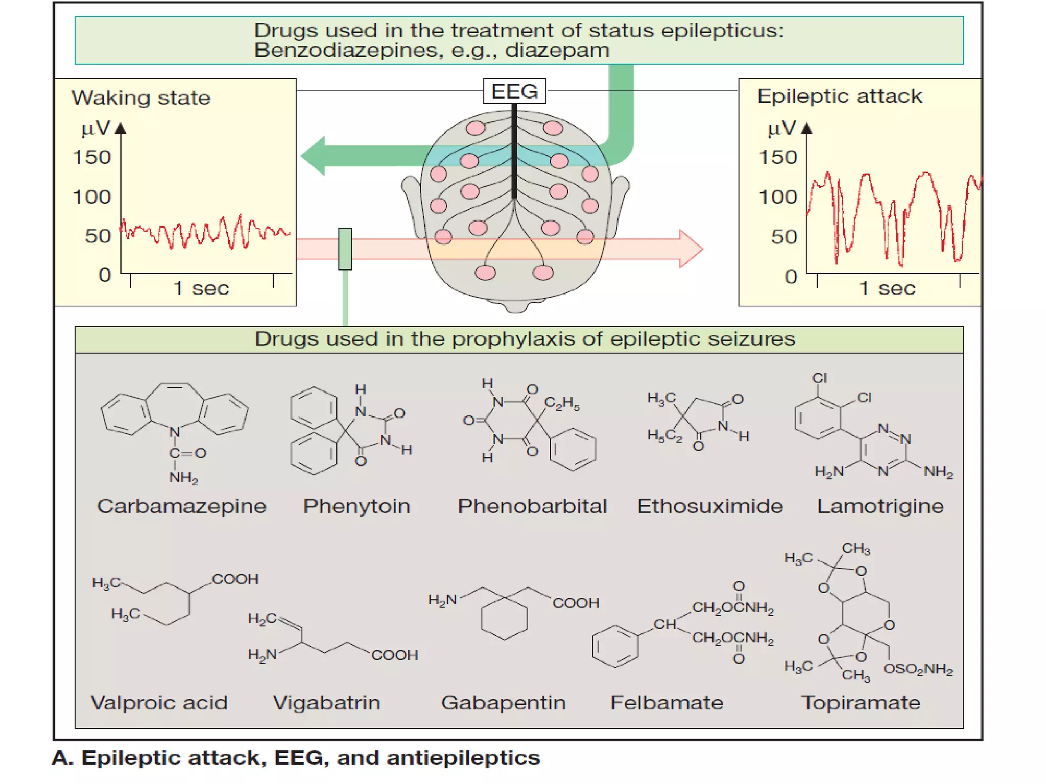 Status epilepticus and treatment