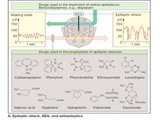Status epilepticus and treatment