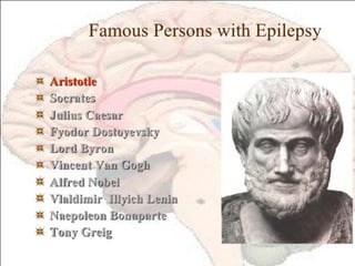 Status epilepticus and treatment