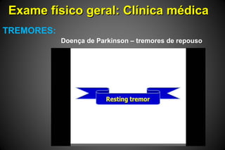 Exame físico geral: Clínica médicaExame físico geral: Clínica médica
TREMORES:
Doença de Parkinson – tremores de repouso
 