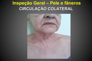 Inspeção Geral – Pele e fâneros
CIRCULAÇÃO COLATERALCIRCULAÇÃO COLATERAL
 