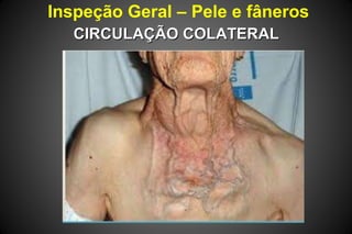 Inspeção Geral – Pele e fâneros
CIRCULAÇÃO COLATERALCIRCULAÇÃO COLATERAL
 
