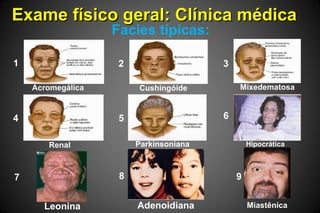 Exame físico geral: Clínica médicaExame físico geral: Clínica médica
Facies típicas:
Miastênica
1 2 3
4 5 6
7 8 9
Acromegálica Cushingóide Mixedematosa
Renal Parkinsoniana Hipocrática
AdenoidianaLeonina
 