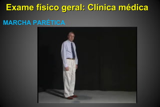 Exame físico geral: Clínica médicaExame físico geral: Clínica médica
MARCHA PARÉTICA
 