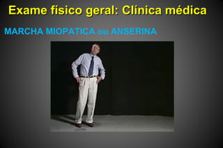 Exame físico geral: Clínica médicaExame físico geral: Clínica médica
MARCHA MIOPATICA ou ANSERINA
 