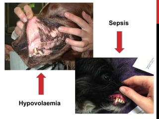 Hypovolaemia
Sepsis
 