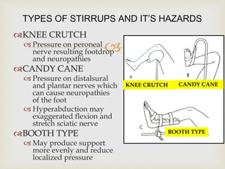 
KNEE CRUTCH
 Pressure on peroneal
nerve resulting footdrop
and neuropathies
CANDY CANE
 Pressure on distalsural
and plantar nerves which
can cause neuropathies
of the foot
 Hyperabduction may
exaggerated flexion and
stretch sciatic nerve
BOOTH TYPE
 May produce support
more evenly and reduce
localized pressure
TYPES OF STIRRUPS AND IT’S HAZARDS
KNEE CRUTCH CANDY CANE
BOOTH TYPE
 