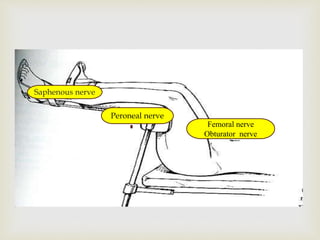 Saphenous nerve
Peroneal nerve
Femoral nerve
Obturator nerve
 