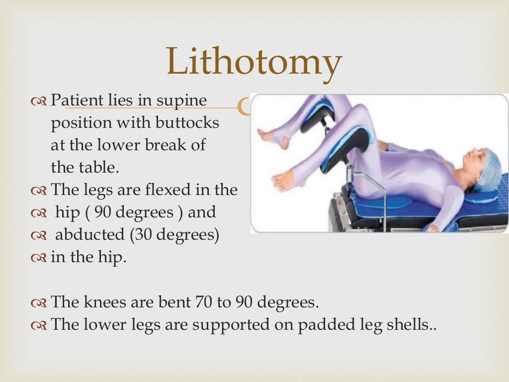 Lithotomy position abdullah