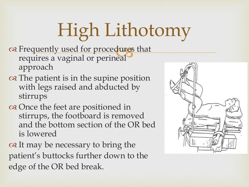 Lithotomy position abdullah