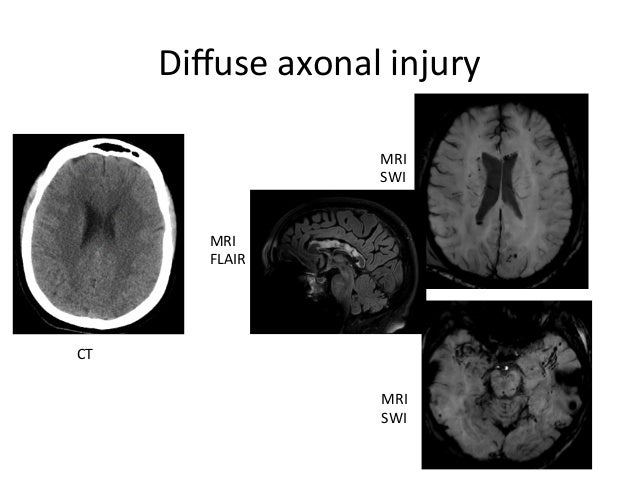 Medicare mri copay