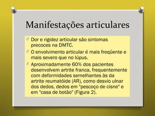 Manifestações articulares
O Dor e rigidez articular são sintomas
precoces na DMTC.
O O envolvimento articular é mais freqüente e
mais severo que no lúpus.
O Aproximadamente 60% dos pacientes
desenvolvem artrite franca, frequentemente
com deformidades semelhantes às da
artrite reumatóide (AR), como desvio ulnar
dos dedos, dedos em "pescoço de cisne" e
em "casa de botão" (Figura 2).
 