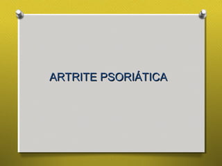 ARTRITE PSORIÁTICAARTRITE PSORIÁTICA
 