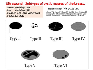 Jy seror breast cyst benign or malignant jfim hanoi 2015 | PDF