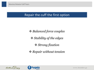 Massive Rotator Cuff Tears
Repair the cuff the first option
 Balanced force couples
 Stability of the edges
 Strong fixation
 Repair without tension
www.shoulder.gr
 