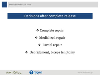 Massive Rotator Cuff Tears
Decisions after complete release
 Complete repair
 Medialized repair
 Partial repair
 Debridement, biceps tenotomy
www.shoulder.gr
 