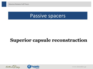 Massive Rotator Cuff Tears
Passive spacers
www.shoulder.gr
Superior capsule reconstraction
 