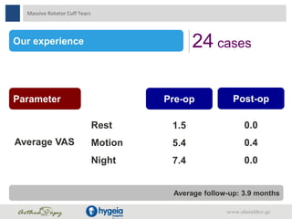 Our experience 24 cases
Average VAS
Rest
Motion
Night
1.5
5.4
7.4
0.0
0.4
0.0
Parameter Pre-op Post-op
Average follow-up: 3.9 months
Massive Rotator Cuff Tears
www.shoulder.gr
 