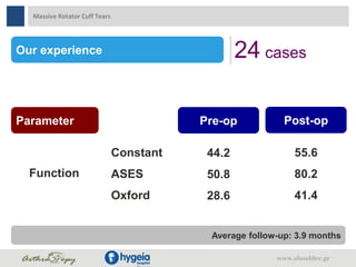Our experience 24 cases
Parameter Pre-op Post-op
Function
Constant
ASES
Oxford
44.2
50.8
28.6
55.6
80.2
41.4
Average follow-up: 3.9 months
Massive Rotator Cuff Tears
www.shoulder.gr
 