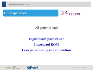 Our experience 24 cases
All patients had:
Significant pain relief
Increased ROM
Less pain during rehabilitation
Massive Rotator Cuff Tears
www.shoulder.gr
 