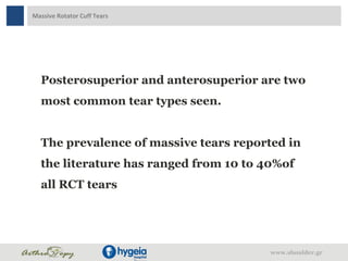 Massive Rotator Cuff Tears
Posterosuperior and anterosuperior are two
most common tear types seen.
The prevalence of massive tears reported in
the literature has ranged from 10 to 40%of
all RCT tears
www.shoulder.gr
 