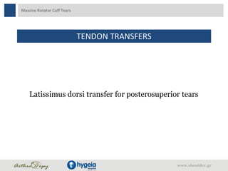 Massive Rotator Cuff Tears
TENDON TRANSFERS
www.shoulder.gr
Latissimus dorsi transfer for posterosuperior tears
 