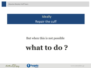 Massive Rotator Cuff Tears
Ideally
Repair the cuff
But when this is not possible
what to do ?
www.shoulder.gr
 