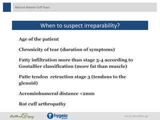 Massive Rotator Cuff Tears
When to suspect irreparability?
Age of the patient
Chronicity of tear (duration of symptoms)
Fa...