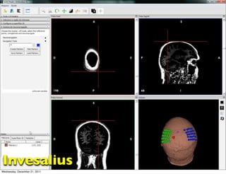 Invesalius
Wednesday, December 21, 2011
 